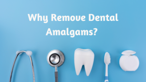 dental amalgams